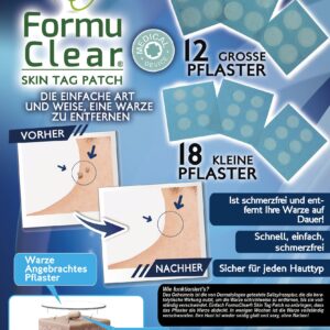 Formu Clear Skin Tag Patch - Sortiment mit 30 Stück - Warzenpflaster